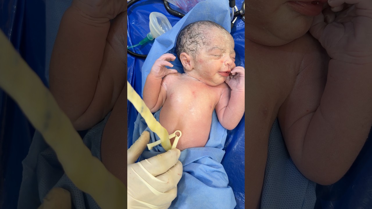 #baby