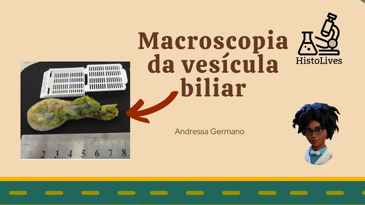 Macroscopia da vesícula biliar