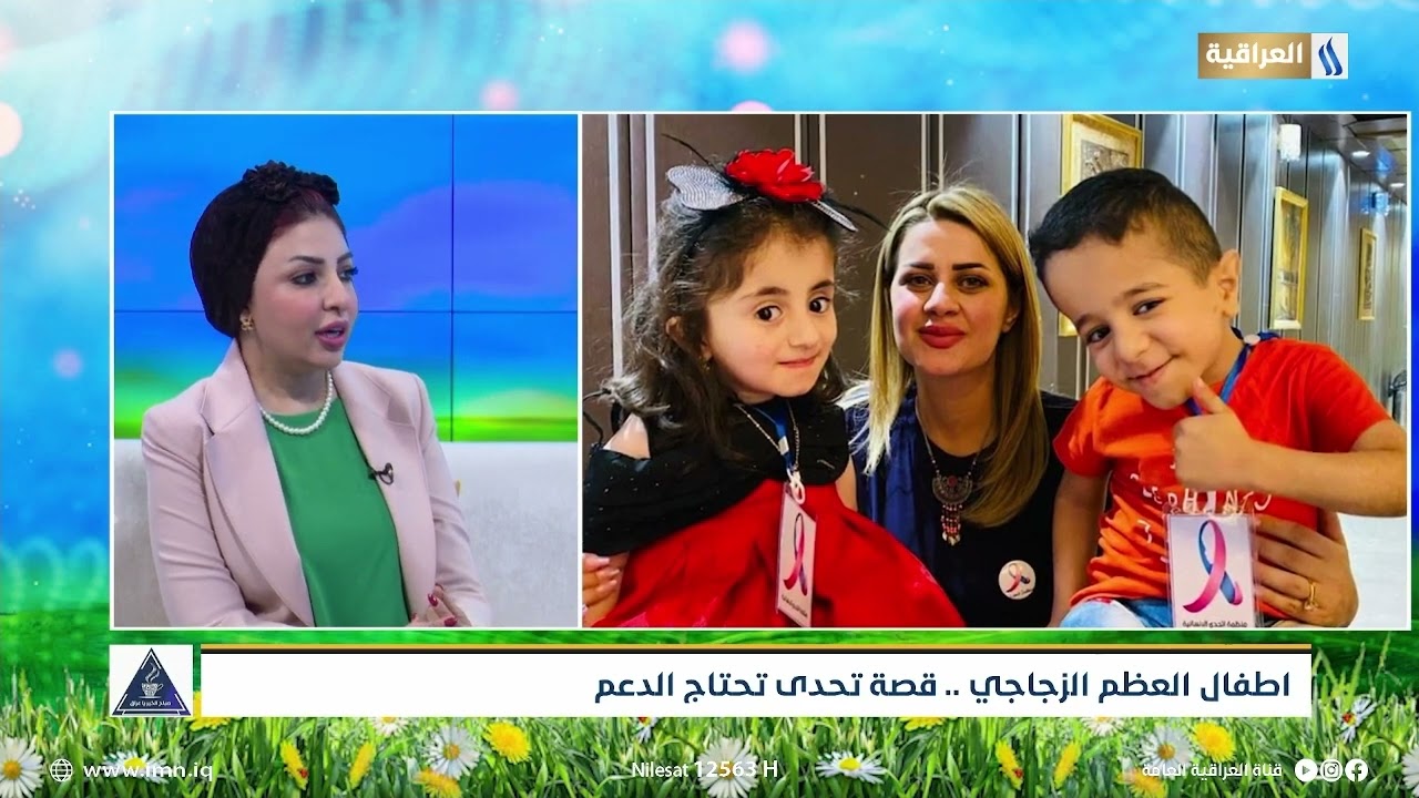 اطفال العظم الزجاجي .. قصة تحدي تحتاج الدعم | الضيف |  د.رشا طه حميد | منظمة اتحدى الانسانية للطفولة