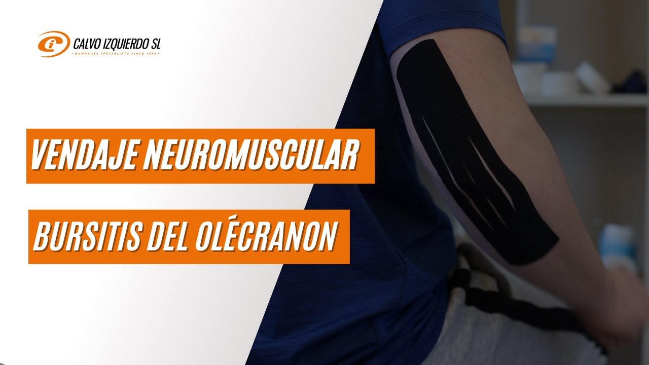Vendaje neuromuscular para la bursitis de codo o del olécranon