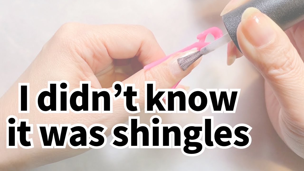 I didn't know it was shingles