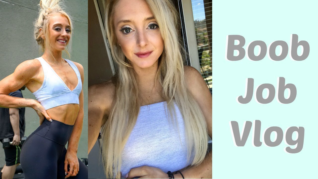 BREAST AUGMENTATION EXPERIENCE| DAYS 1-5 POST OP