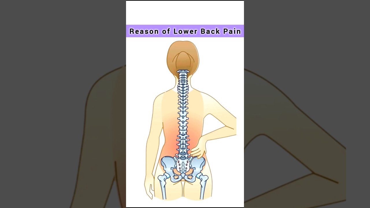 Reason of Lower Back Pain #physiotherapy
