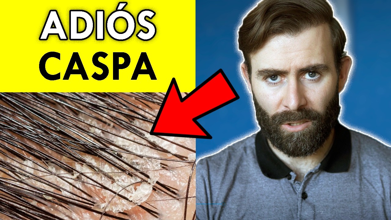 Cómo Eliminar Caspa Y Dermatitis Según La Ciencia