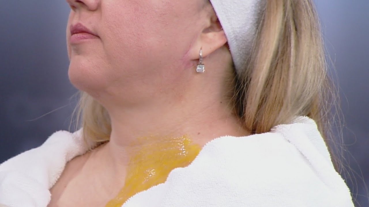 ¿Arrugas en el cuello y el pecho? Este remedio casero te puede ayudar a eliminarlas