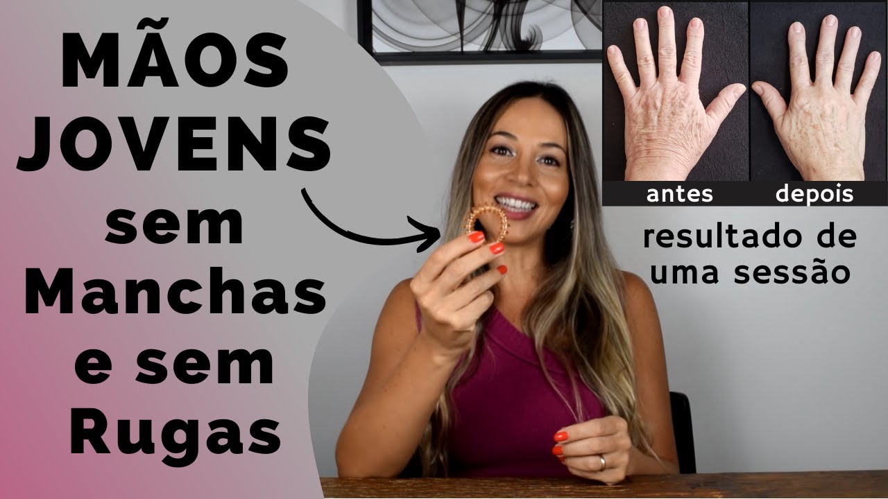 Como Tirar as Manchas e as Rugas das Mãos - Tenha Mãos JOVENS, Macias e Saudáveis