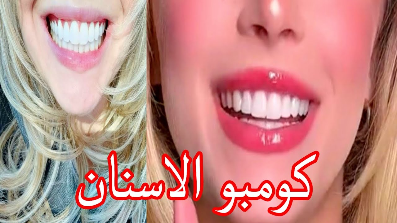 أسنان بيضاء ومتراصة ولثة وردية | سبليمينال الجمال الفموي الكامل 💎 نتيجة من اول اسبوع 😎