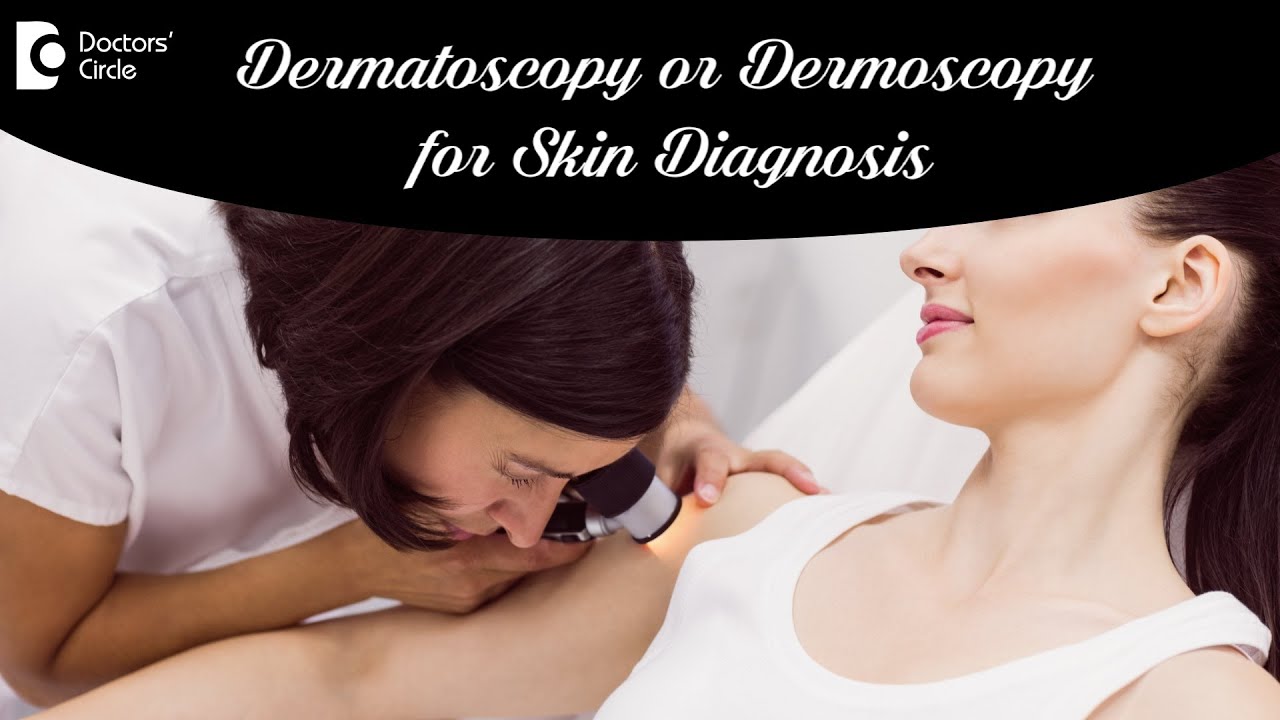 DERMOSCOPY /DERMATOSCOPY. How & Why is it done? Causes & Treatment-Dr.Aruna Prasad | Doctors' Circle