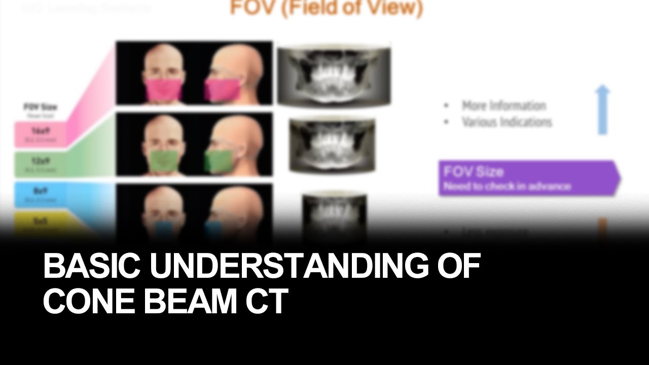 Basic understanding of cone beam CT