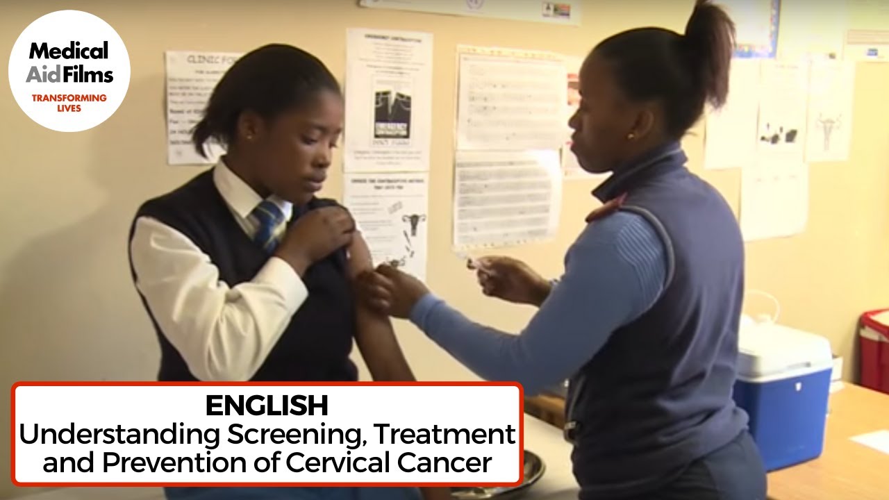 Understanding screening treatment and prevention of cervical cancer