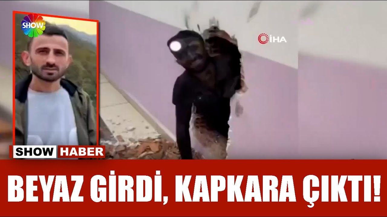 Bacadan düştü, tanınmaz hale geldi!