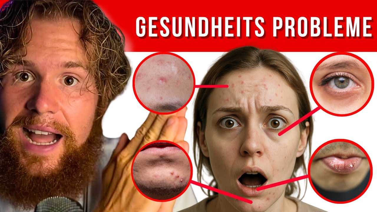 12 Komische Zeichen die dein Gesicht &uuml;ber deine Gesundheit aussagt