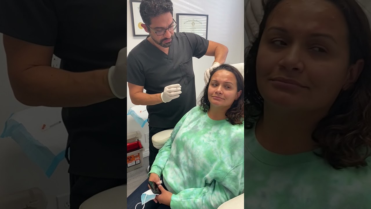 botox/dysport injections before and after