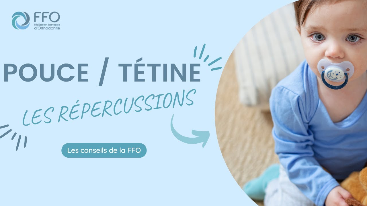 Les répercussions de la succion du pouce ou de la tétine