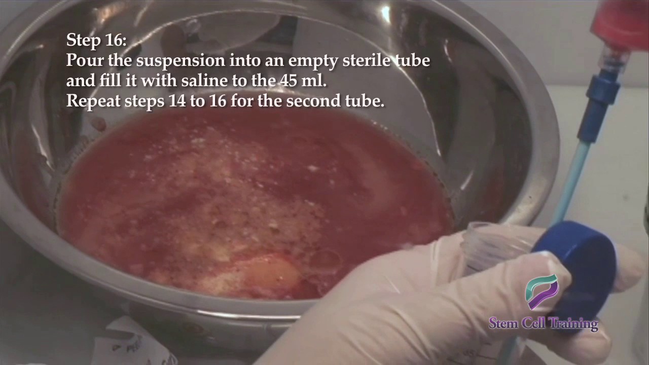 SVF Isolation Video