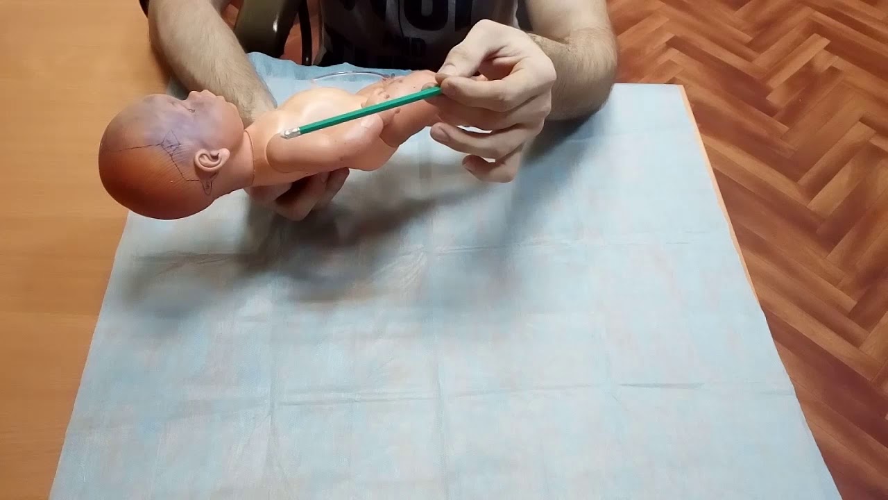 Швы и роднички черепа новорожденного