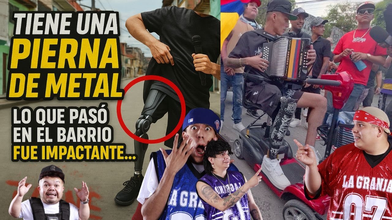Reveló su pierna hidráulica… y todos en el barrio quedaron en shock