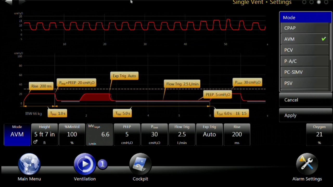 bellavista Ventilator: Adaptive Ventilation Mode
