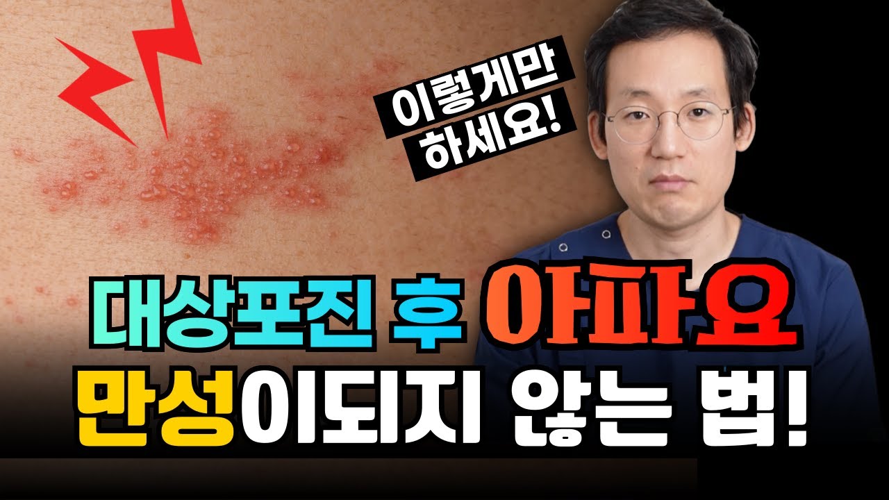 대상포진 걸렸다면 얼른 이 영상 보세요! 만성이 되지 않는 법 #대상포진신경통
