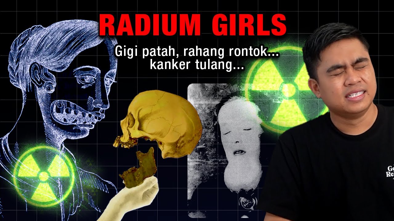 Ketika 4.000 Orang Pekerja Pabrik Terkena Racun Radioaktif Berbahaya. (Radium Girls)