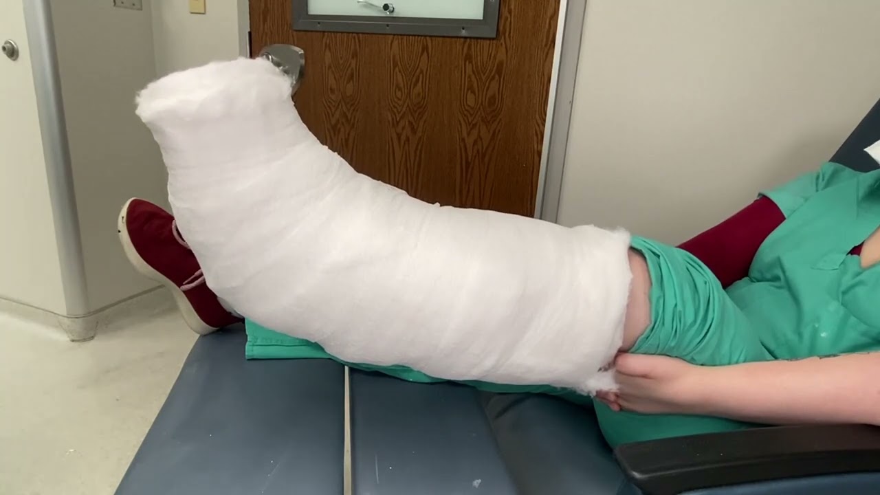 Robert Jones Splint For Calcaneus Fractures
