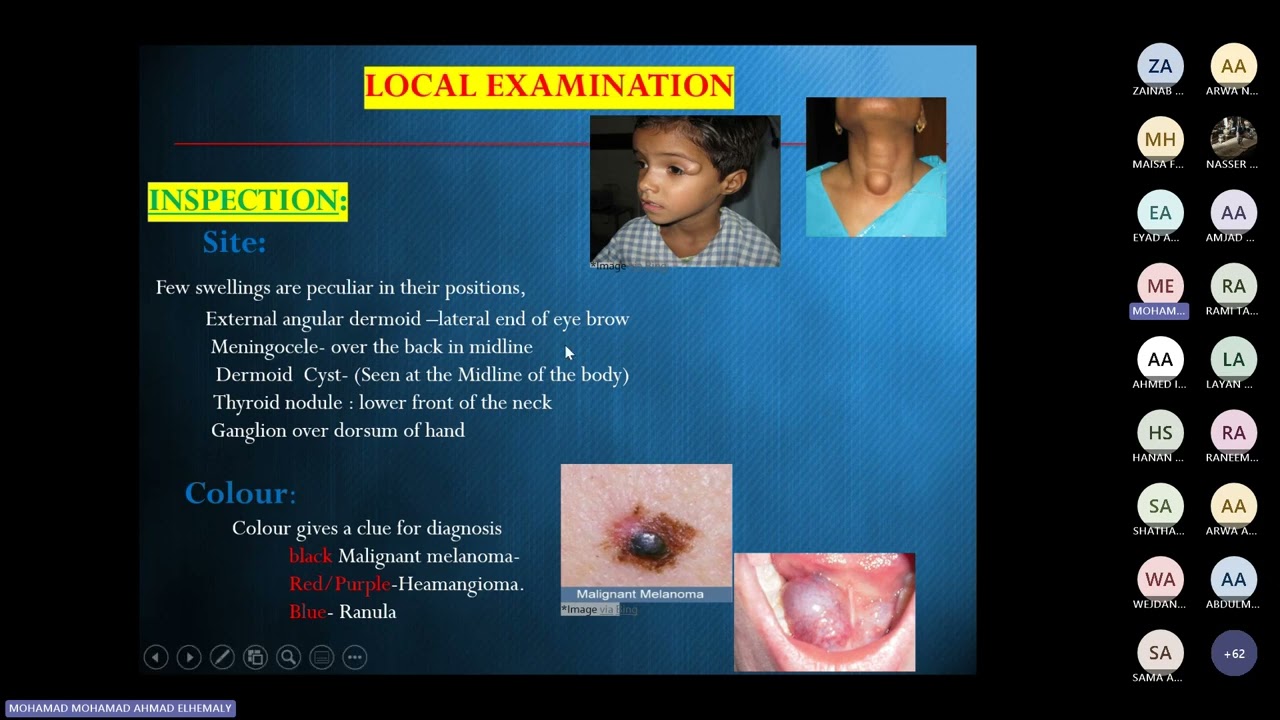 ECE examination of swelling