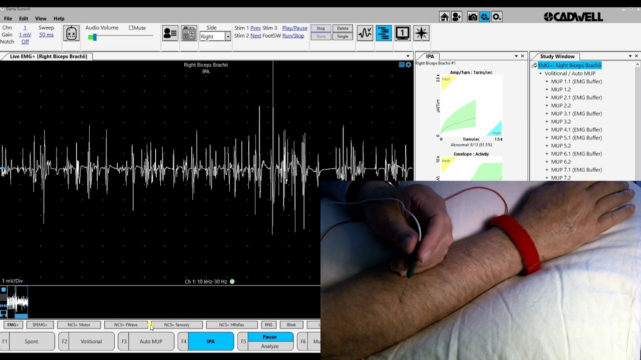 QEMG Demo
