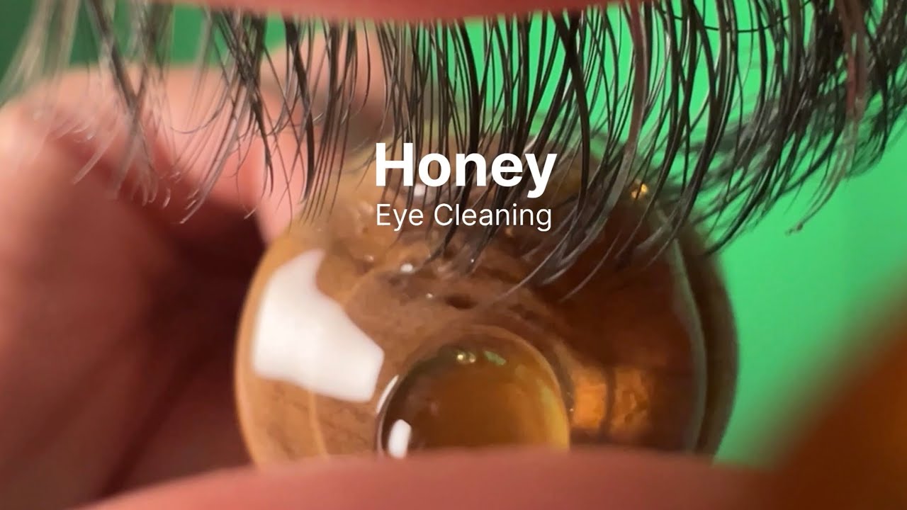 Honey Eye Cleaning👁️🍯