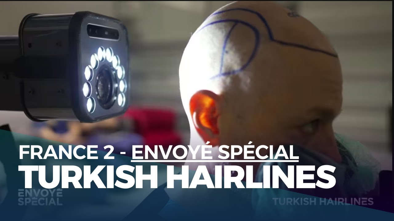 France 2 - Envoyé spécial - Une technologie futuriste au service de la greffe de cheveux