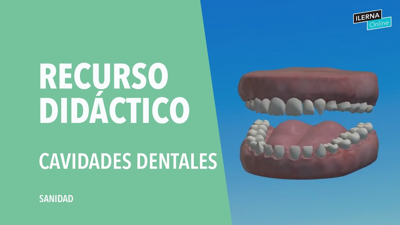 Clasificación de las cavidades dentales, según Black