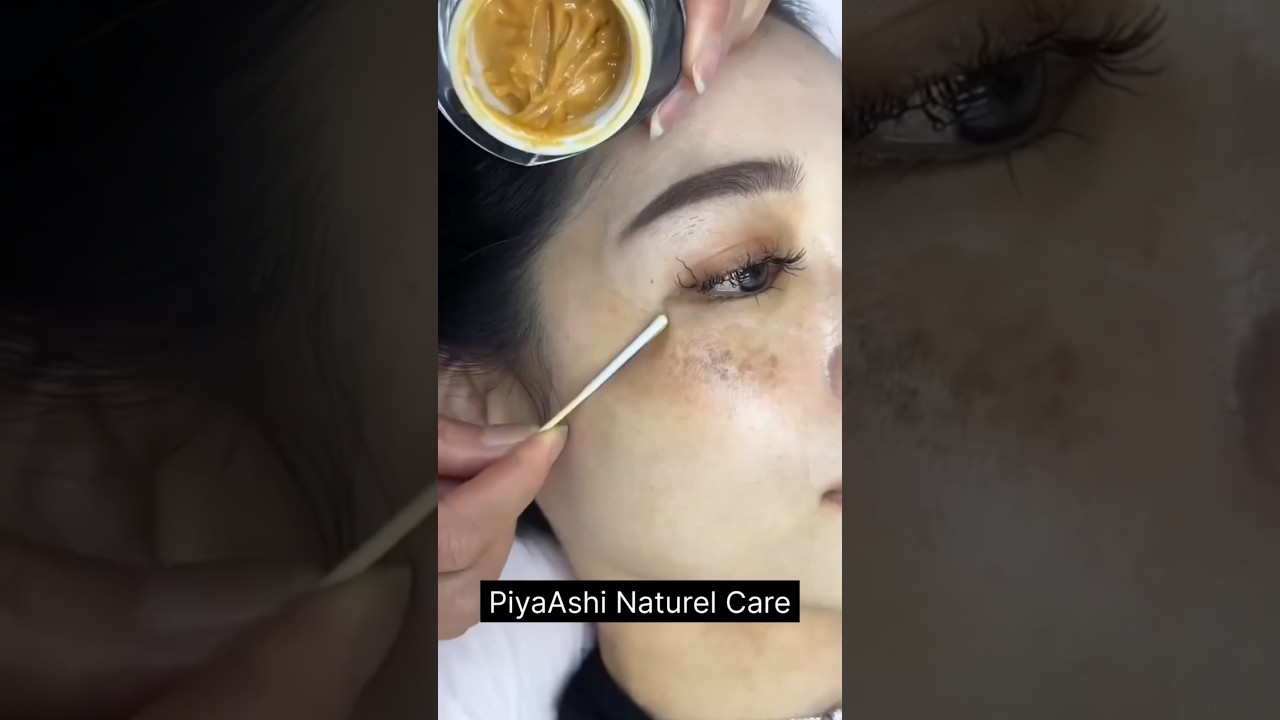 Viral pigmentation & melasma cream? #skincare #pigmentation #melasma #fairskinathome #shorts #ytshor