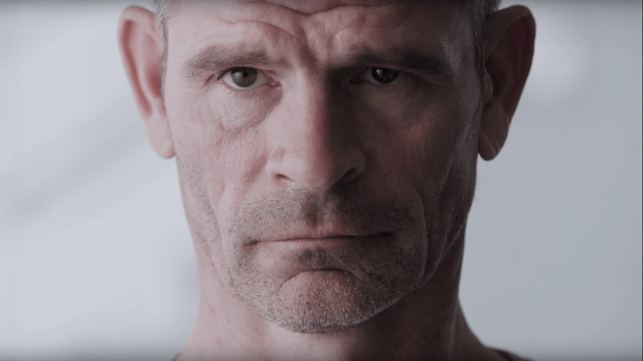 RHEO KNEE XC by Össur - French