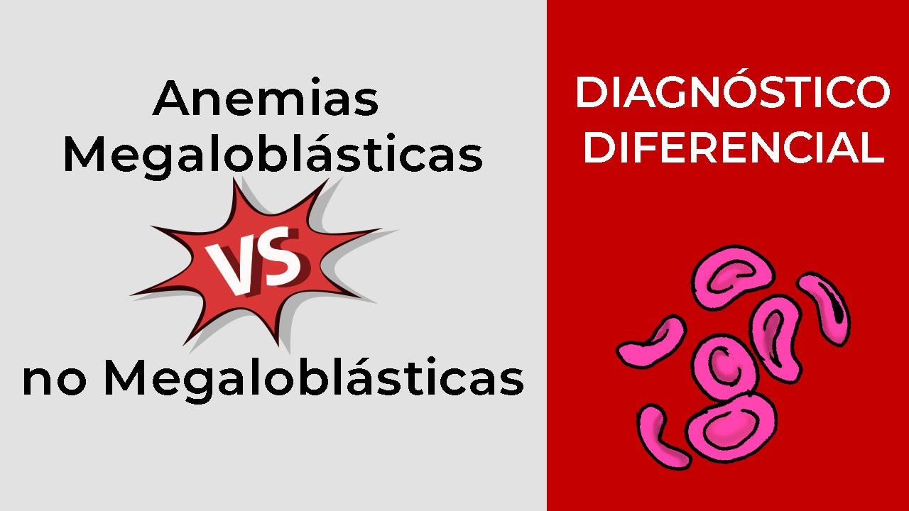 Diagnóstico Diferencial. Anemias Megaloblásticas vs no Megaloblásticas