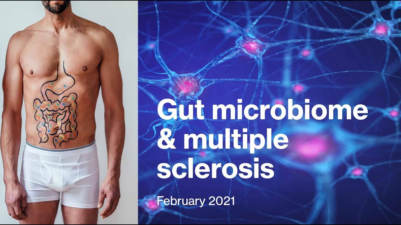 The Gut Microbiome In Multiple Sclerosis - New Research Findings