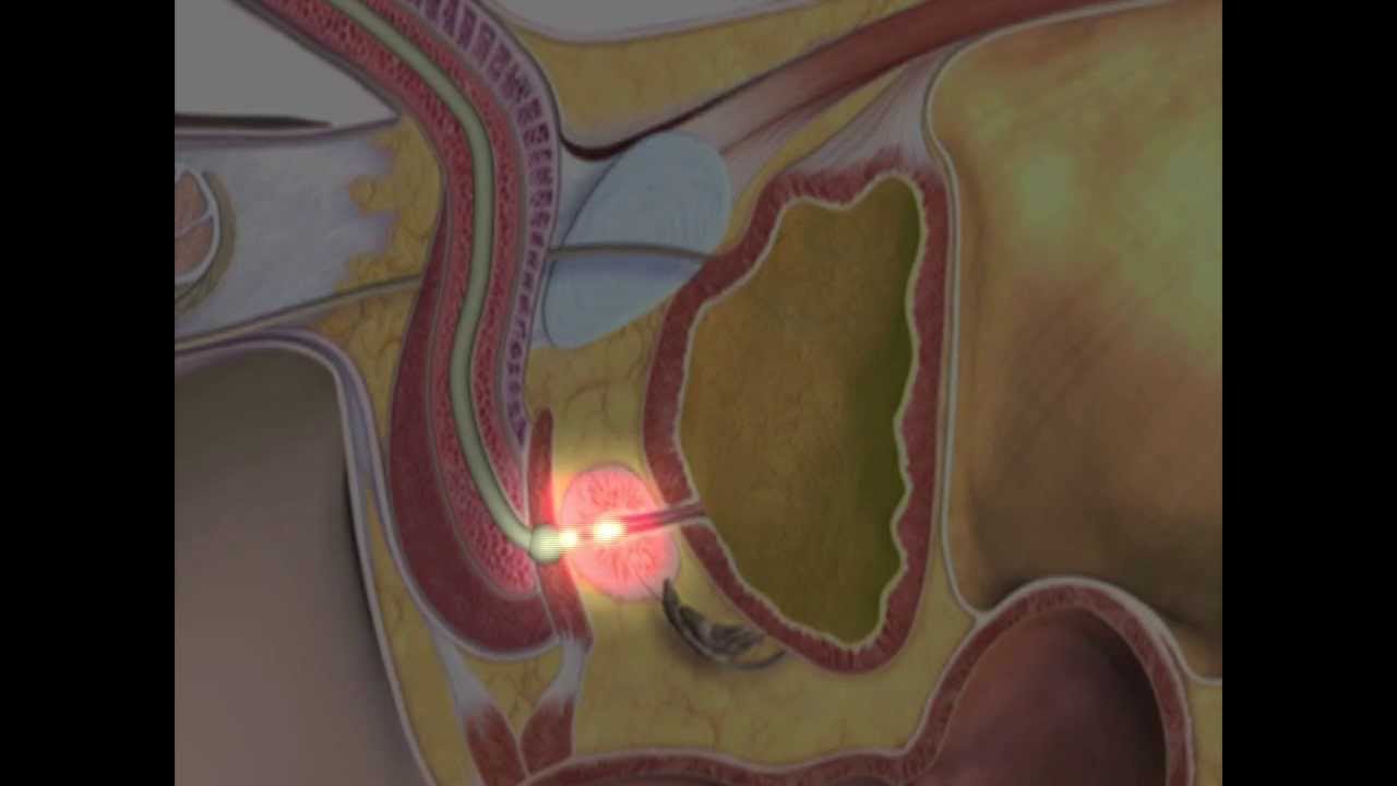 Urinary Catheterisation - Clinical Skills Series