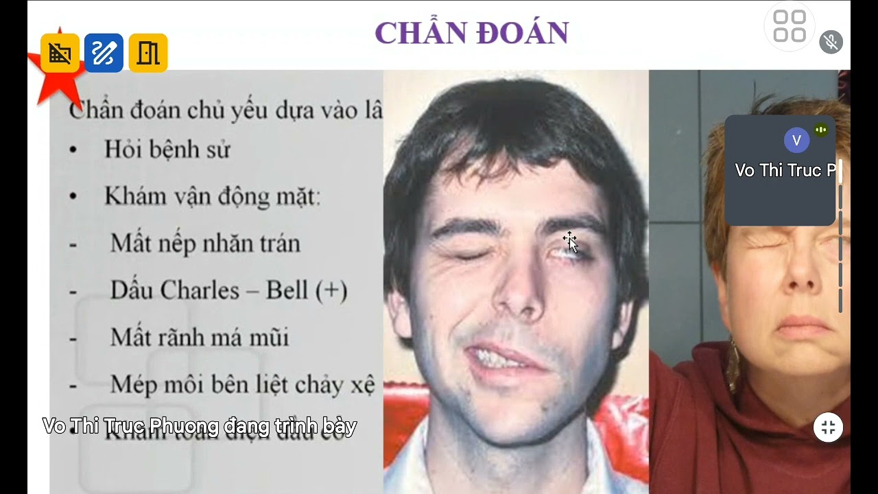 BỆNH HỌC Bài 6 Liệt VII Ngoại Biên