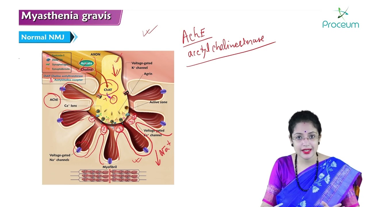 Myasthenia Gravis Part 1 (Hindi) : Internal Medicine