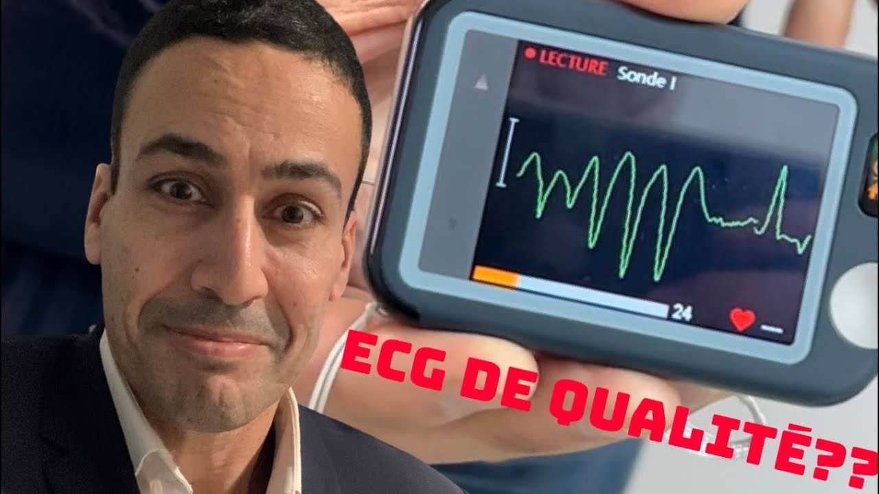 Un enregistreur ECG très surprenant !