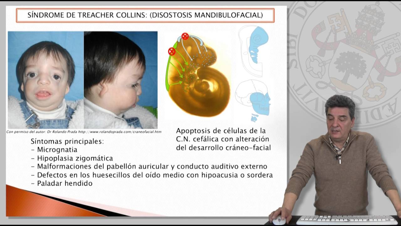 NEUROCRISTOPAT&Iacute;AS