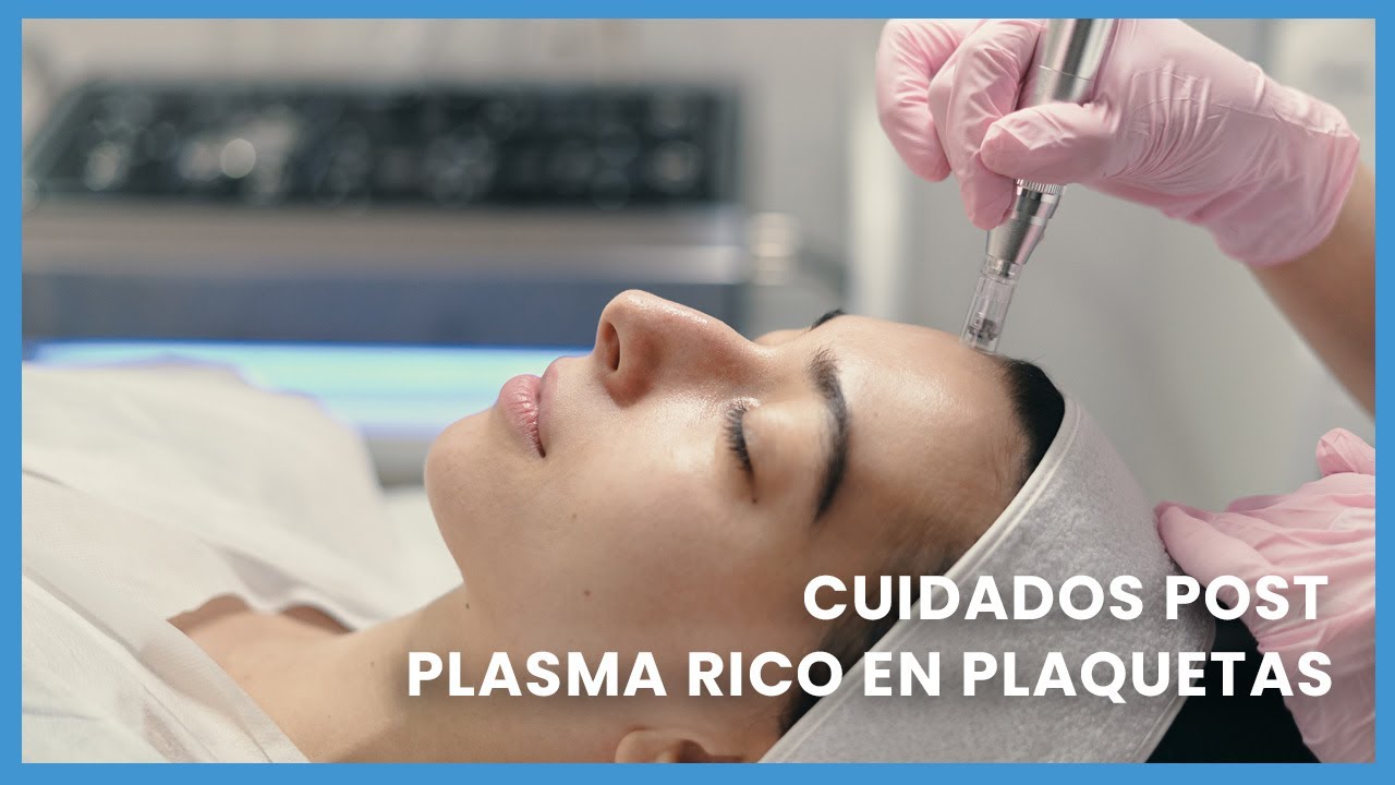 8 cuidados básicos después de un Plasma Rico en Plaquetas