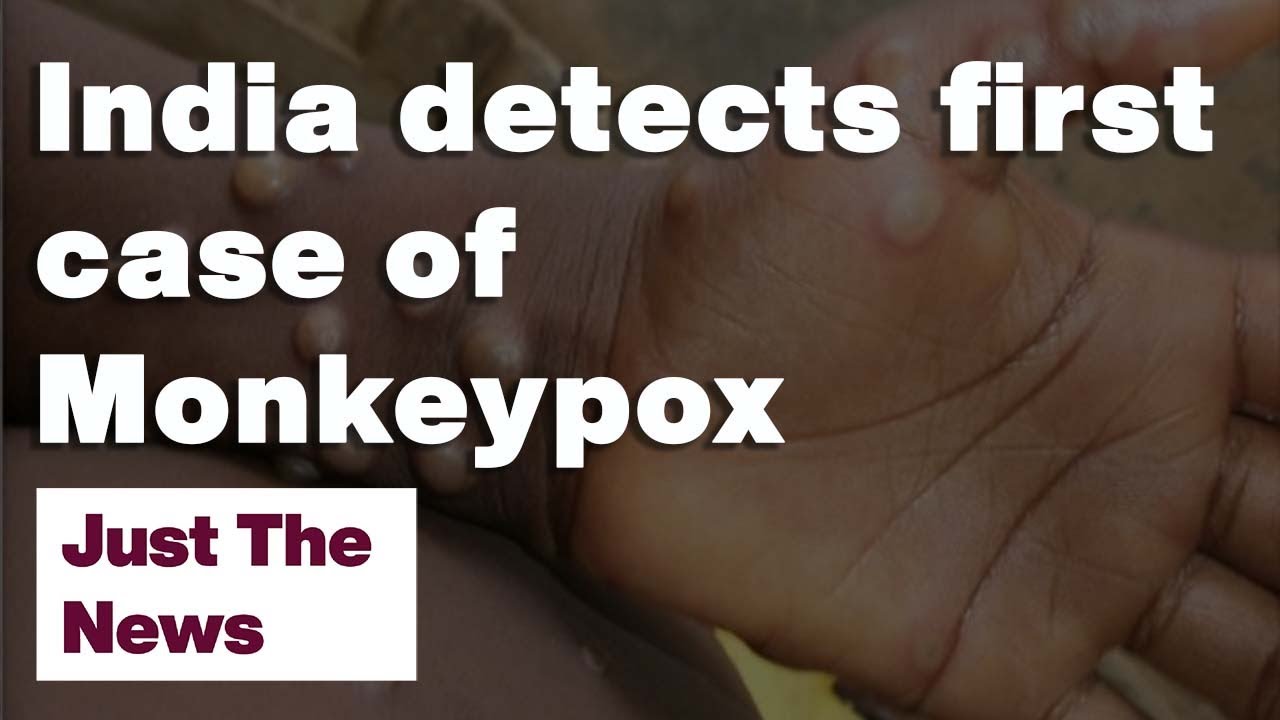 Kerala issues statewide alert as India detects its first case of Monkeypox: Just The News:15-07-2022