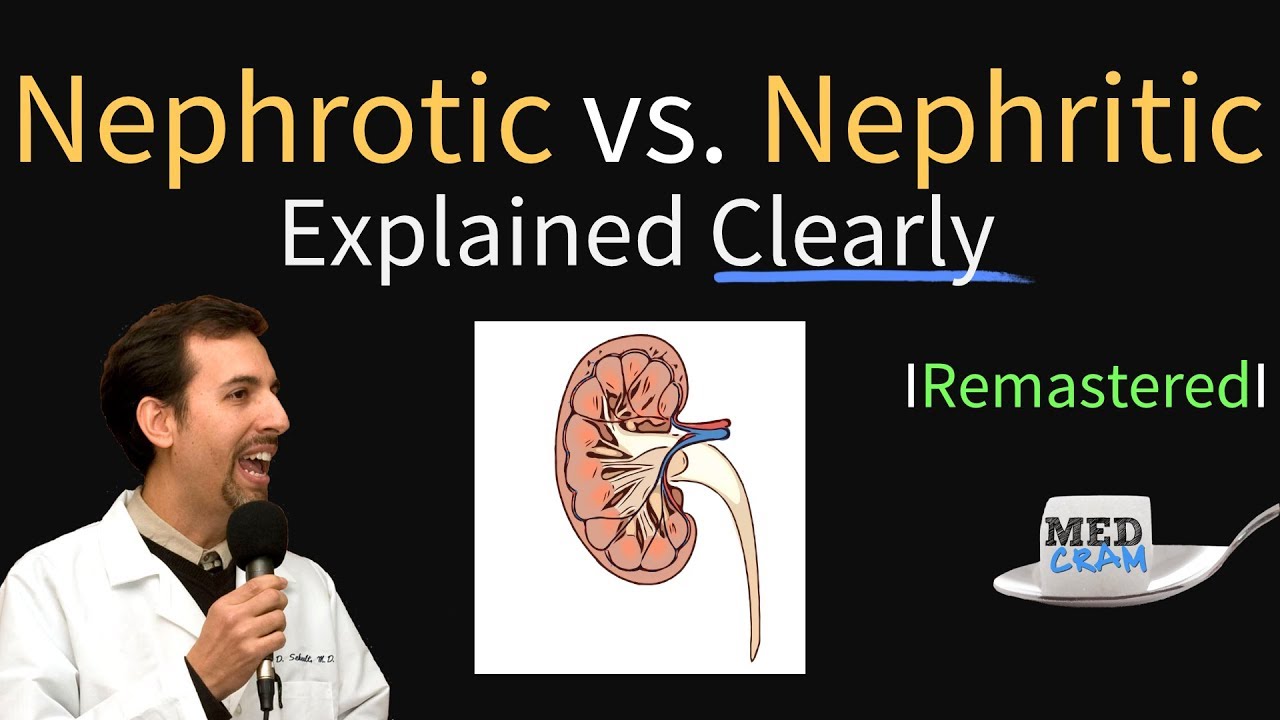 Nephrotic vs Nephritic Syndrome (Proteinuria, Hematuria, Casts)
