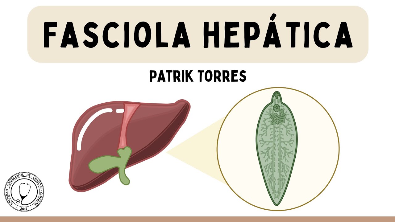 Fasciola hepatica
