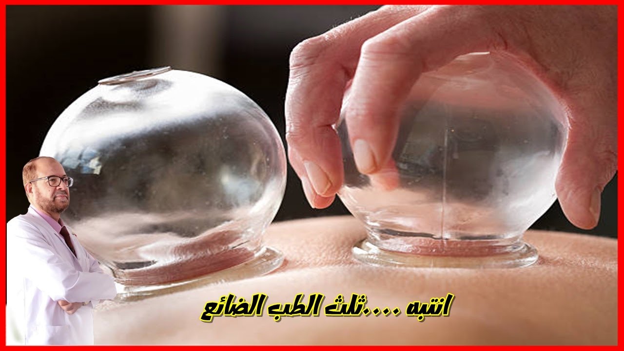 ما لا تعرفه عن الحجامة | دكتور جودة محمد عواد | دكتور جودة محمد عواد