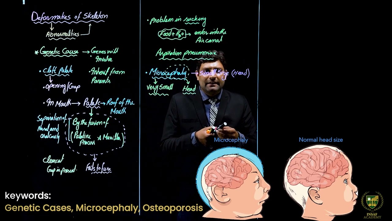 Deformities of Skeleton || 12TH BIOLOGY || CHP 16 || LECTURE 15 ||