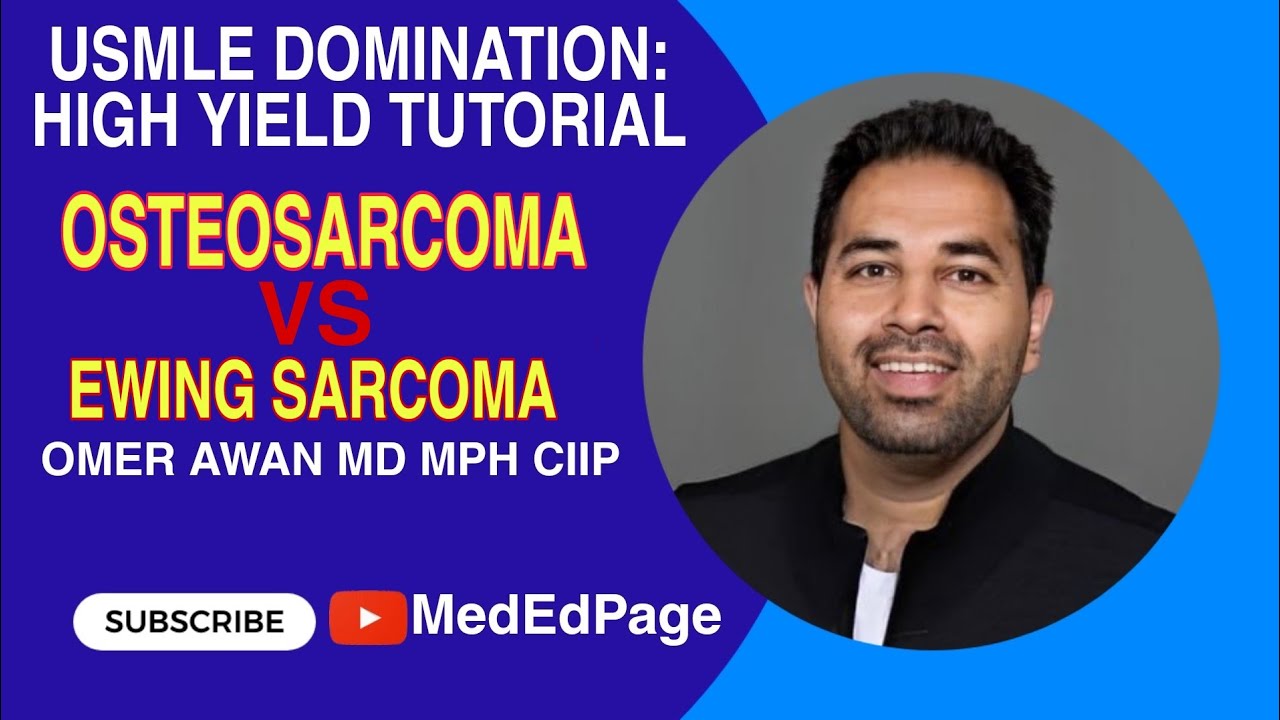 USMLE DOMINATION: HIGH YIELD TUTORIAL #1- Osteosarcoma vs. Ewing sarcoma