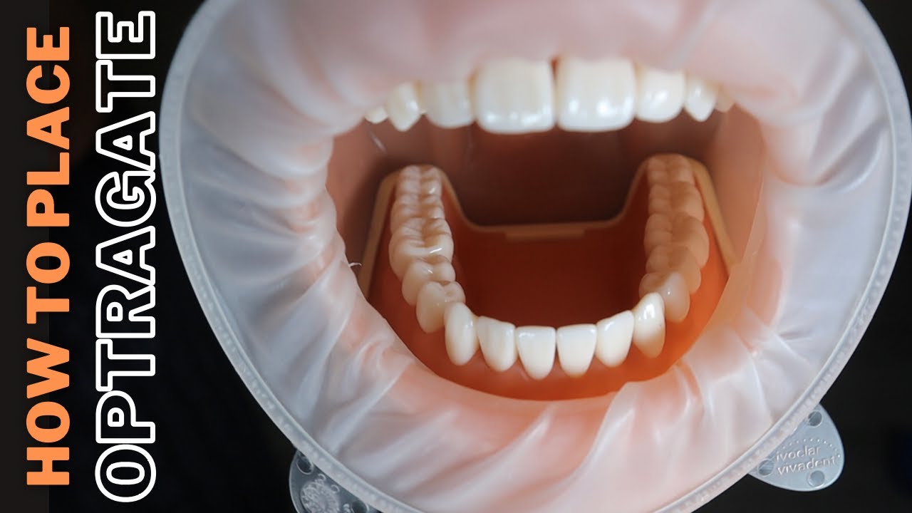 Optragate and My Notorious Dummy Patient 🟢 How To Place Optragate and is it useful??/
