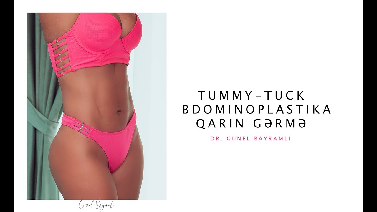 Abdominoplastika  Qarın gərmə əməliyyatı   Plastik cərrah Op  Dr  Günel Bayramlı