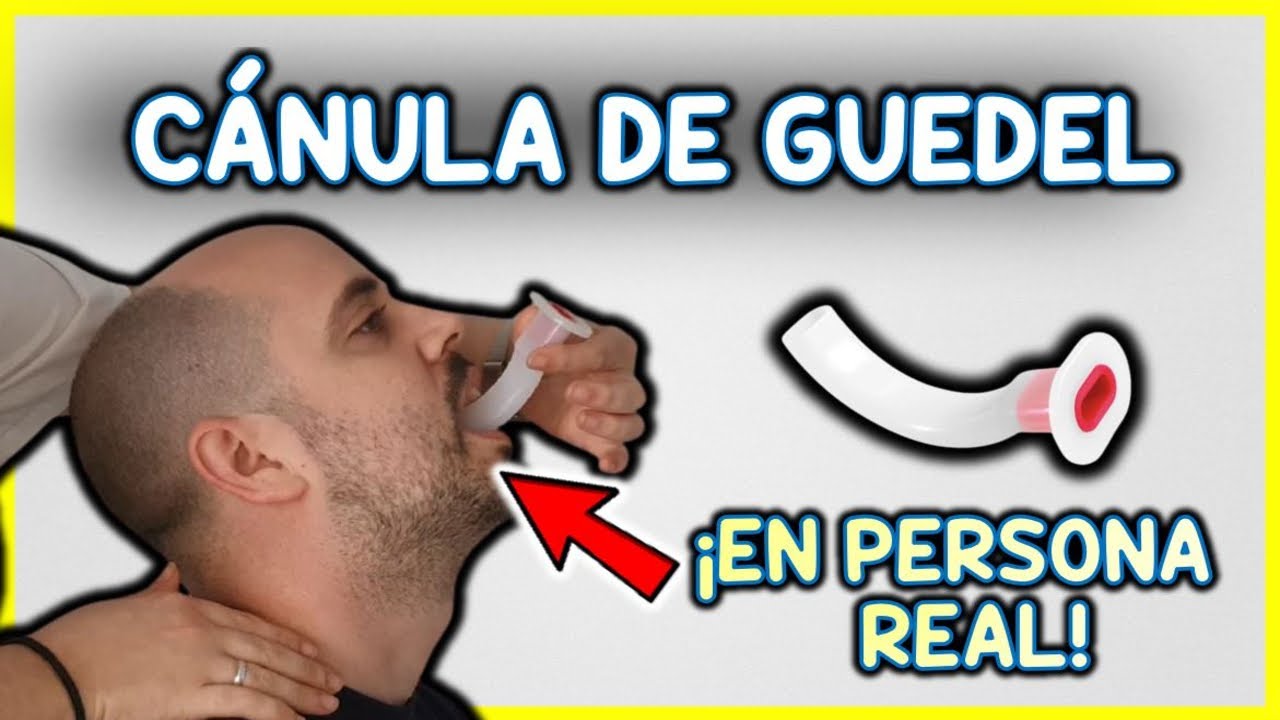 C&oacute;mo COLOCAR C&Aacute;NULA DE GUEDEL en una PERSONA REAL | C&aacute;nula orofar&iacute;ngea |&iquest;Qu&eacute; TAMA&Ntilde;O elegir?