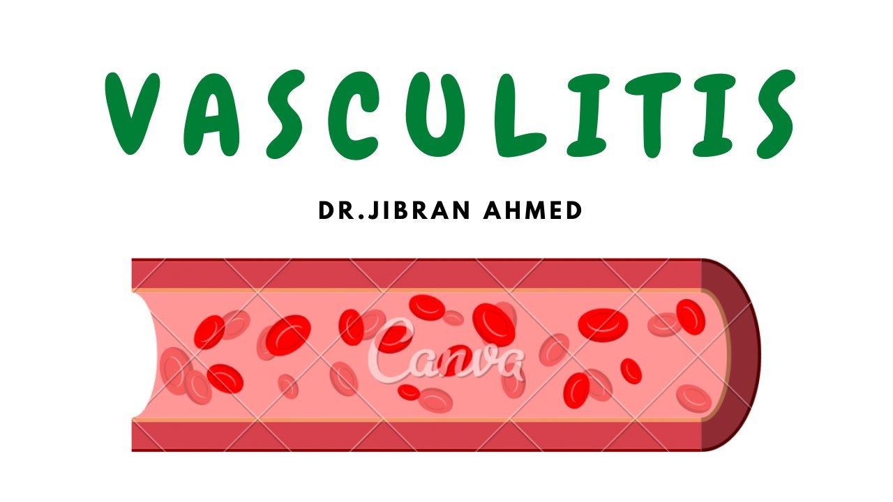 VASCULITIS II BLOOD VESSELS II SYSTEMIC PATHOLOGY II ROBBINS 10TH E II PATHOLOGY LECTURE